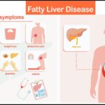 Diet for Fatty Liver: Complete Expert Guide 2025